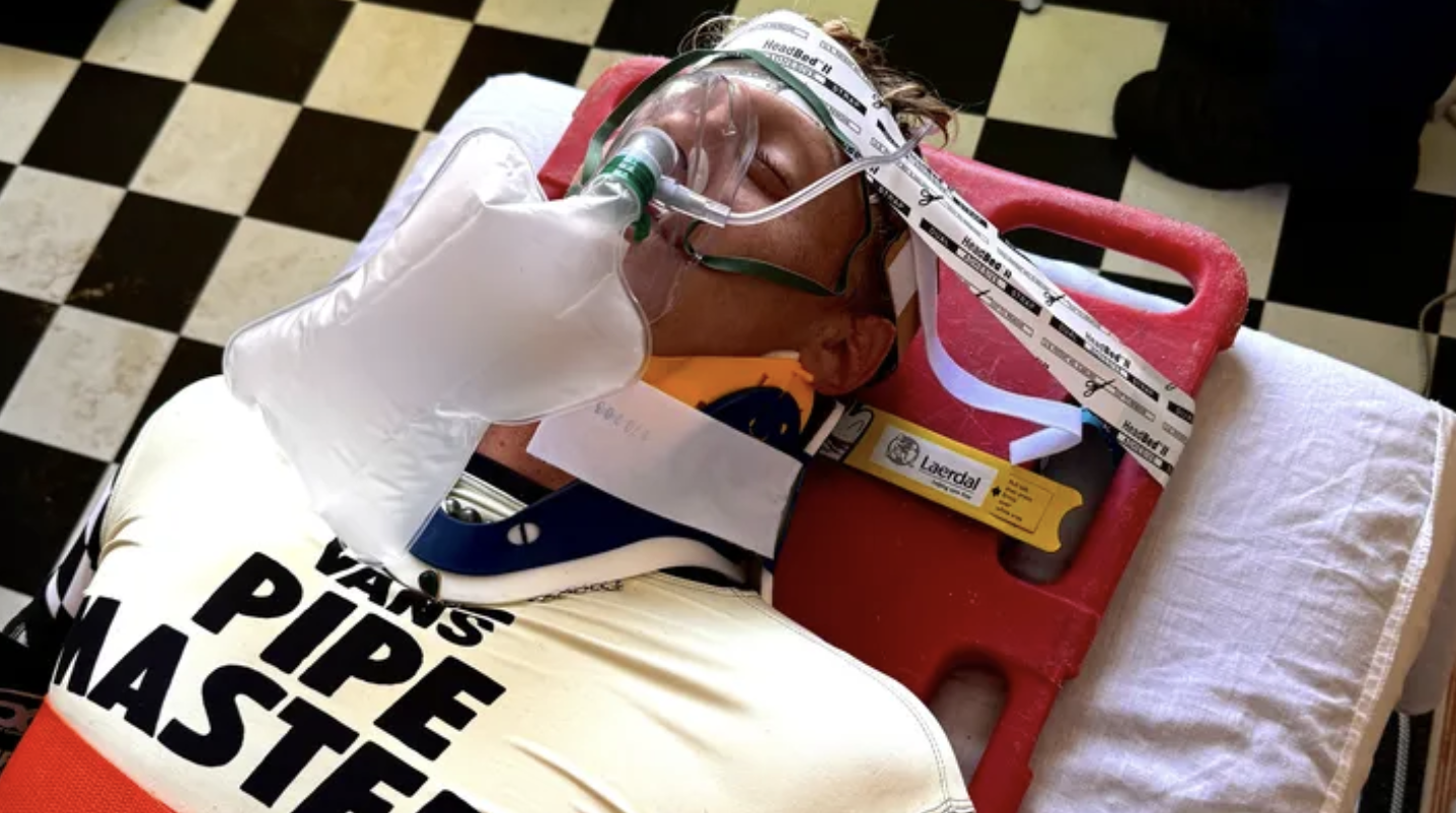 Un estudio revela las lesiones más frecuentes en los surfistas