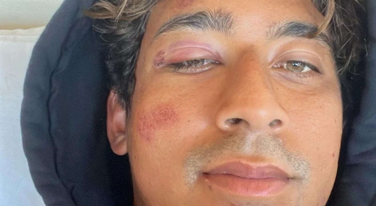 El gran susto de Samuel Pupo en Backdoor